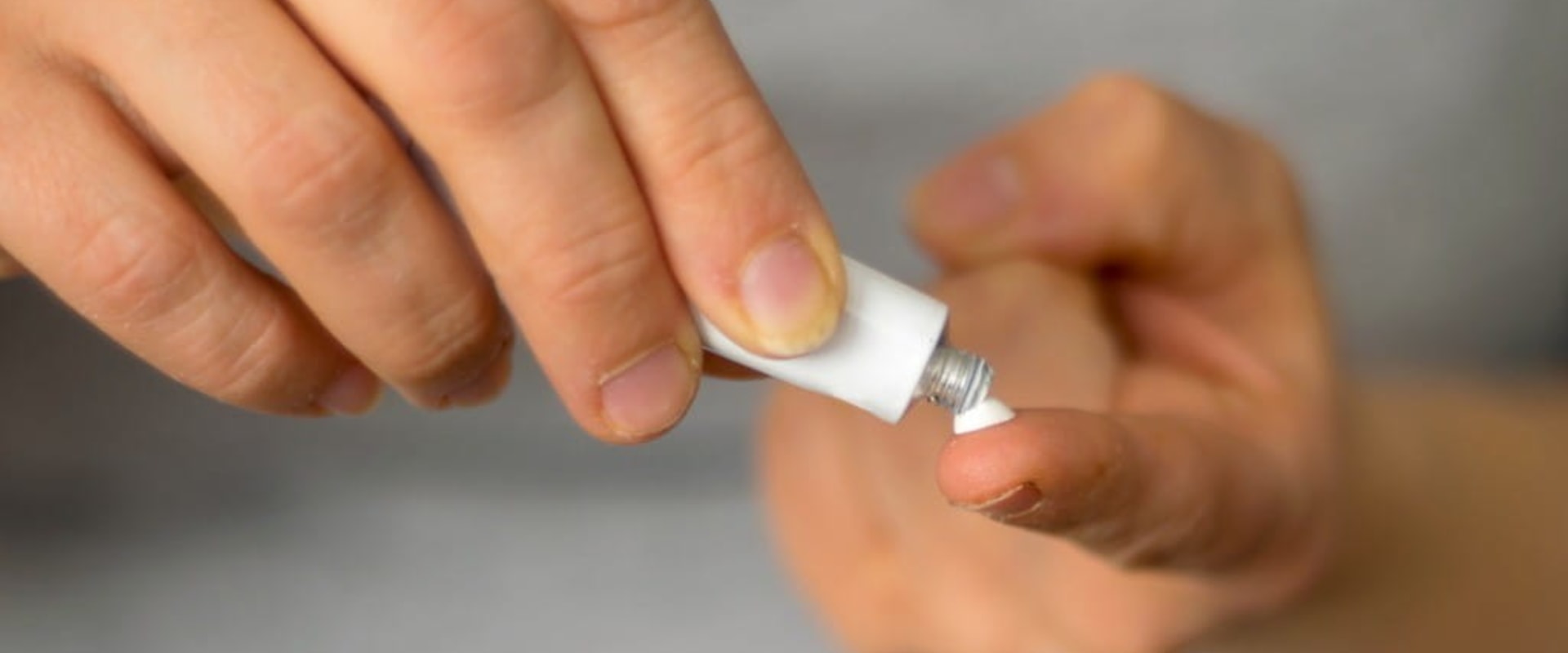 How Long Does It Take for Mupirocin to Work for Impetigo Trusted Medical Insights and Recovery Facts