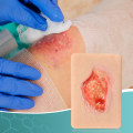 Using Granulation Tissue Wound Pictures for Comprehensive Wound and Eschar Assessment